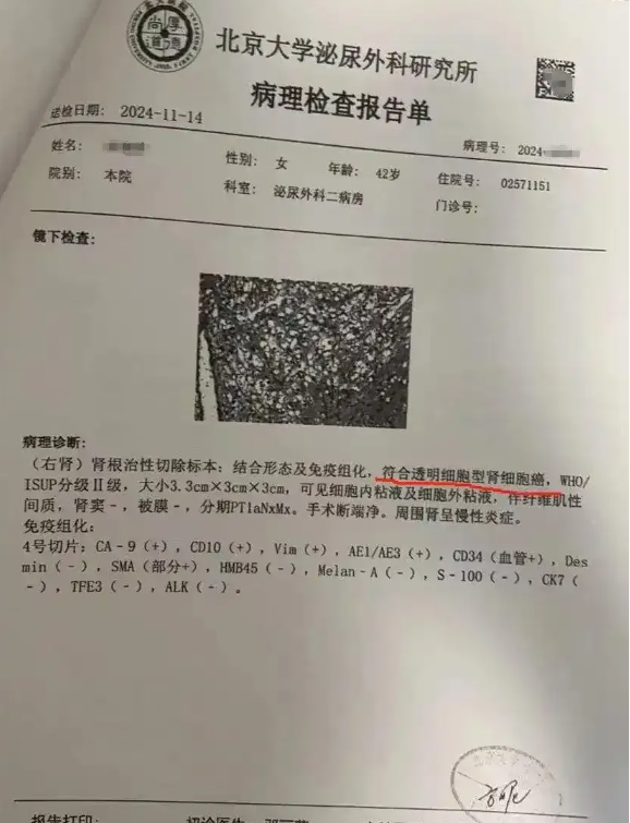 天源国际 体检10年未预警却患癌症，每年体检是否还有意义？_大皖新闻 | 安徽网